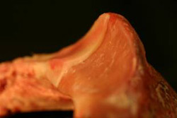 The Extensor Process. showing the Articular Cartilage